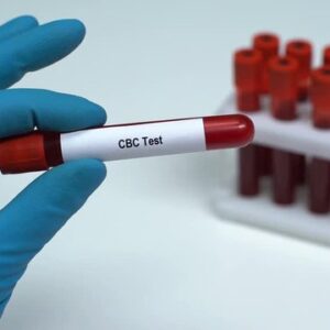 Complete Blood Count (CBC)
