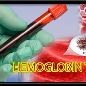 Hemoglobin (Hb)