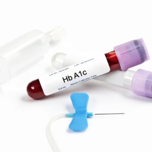 HbA1c