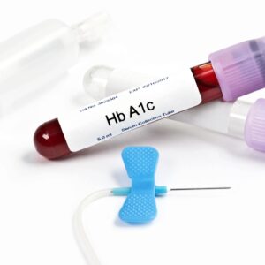 HbA1c