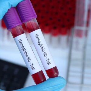 Hemoglobin (Hb)
